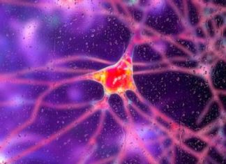 Preliminary gene therapy shows 75% reduction in Huntington’s disease progression