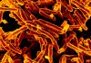 Long a dream, it’s now real: a fast and accurate TB test that doesn’t need phlegm