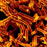 Long a dream, it’s now real: a fast and accurate TB test that doesn’t need phlegm