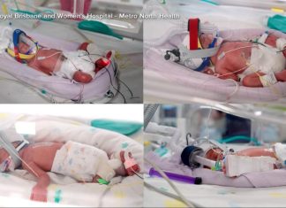 WATCH: Woman gives birth to rare identical quadruplets