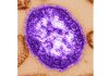 Pennsylvania says an unvaccinated woman has died from measles-related complications Electron microscope image of a measles virus particle. (Cynthia Goldsmith/Centers for Disease Control and Prevention, via AP, File)