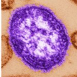 Pennsylvania says an unvaccinated woman has died from measles-related complications Electron microscope image of a measles virus particle. (Cynthia Goldsmith/Centers for Disease Control and Prevention, via AP, File)