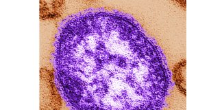 Pennsylvania says an unvaccinated woman has died from measles-related complications Electron microscope image of a measles virus particle. (Cynthia Goldsmith/Centers for Disease Control and Prevention, via AP, File)