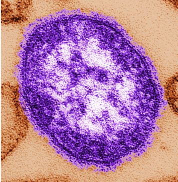 Pennsylvania says an unvaccinated woman has died from measles-related complications Electron microscope image of a measles virus particle. (Cynthia Goldsmith/Centers for Disease Control and Prevention, via AP, File)