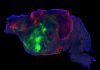 Mice with human brain cells offer a tool to study disease. Ethicists ask: What’s next? This side view of a lab mouse brain shows nerve fibers extending from the human graft (colored with green and red fluorescent proteins) through the mouse brain (colored with blue). Scale bar = 1 mm.