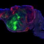 Mice with human brain cells offer a tool to study disease. Ethicists ask: What’s next? This side view of a lab mouse brain shows nerve fibers extending from the human graft (colored with green and red fluorescent proteins) through the mouse brain (colored with blue). Scale bar = 1 mm.