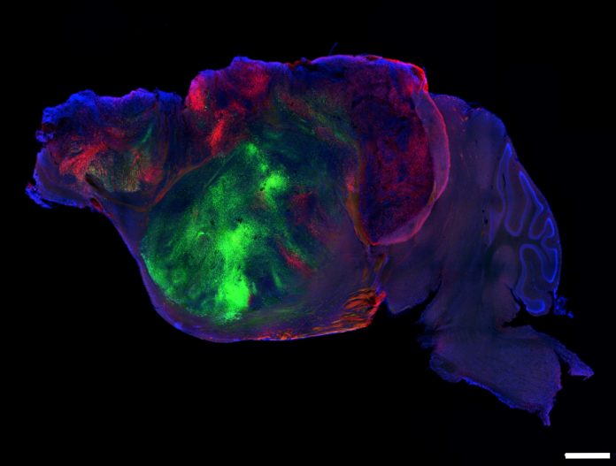This side view of a lab mouse brain shows nerve fibers extending from the human graft (colored with green and red fluorescent proteins) through the mouse brain (colored with blue). Scale bar = 1 mm.