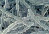 1 death, 5 cases as NYC health officials report another Legionnaires’ disease cluster Legionnaires gty er 260911 1789139696626 hpmain 16x9 1600